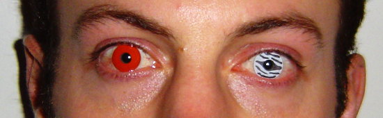 Man with novelty contact lenses
